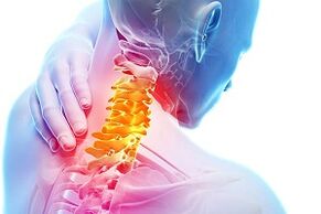 Symptoms of cervical osteochondrosis and rules of eating for illness