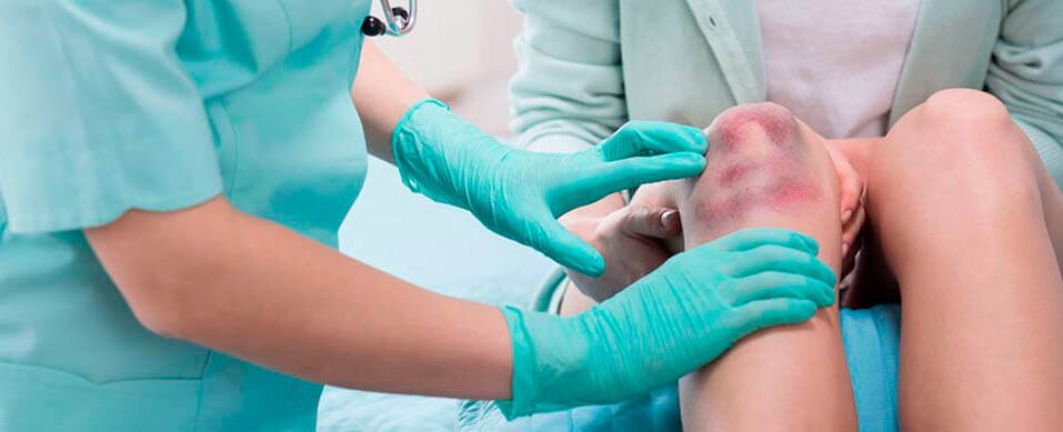a doctor examined a knee injury