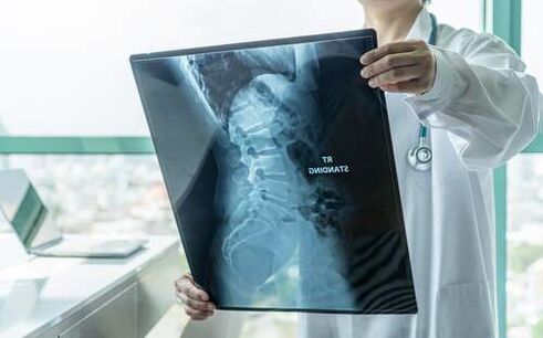 X-ray examination is a necessary diagnostic method if the back hurts
